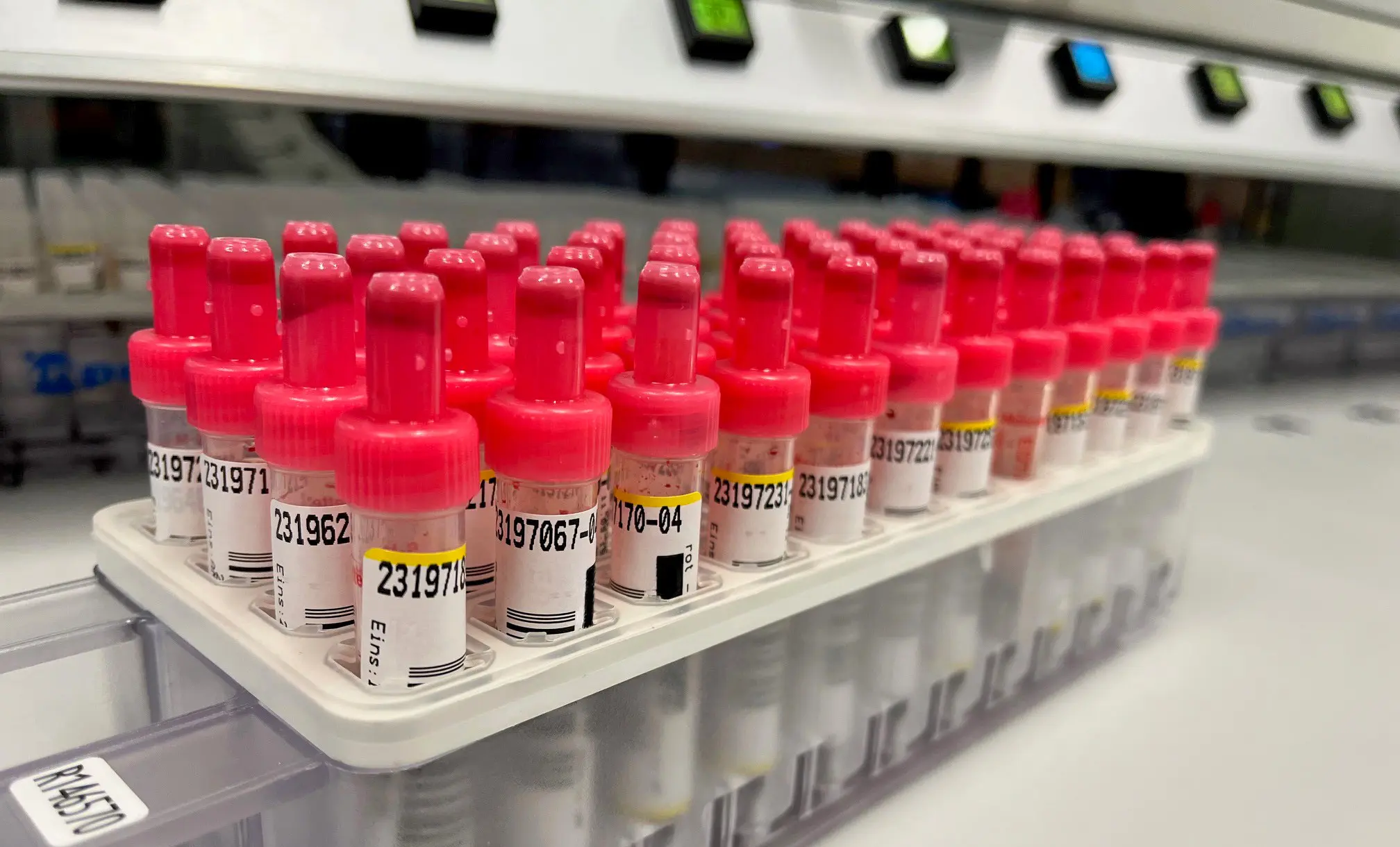 Institut für Laboratoriumsmedizin Rems-Murr Kliniken - Blutröhrchen